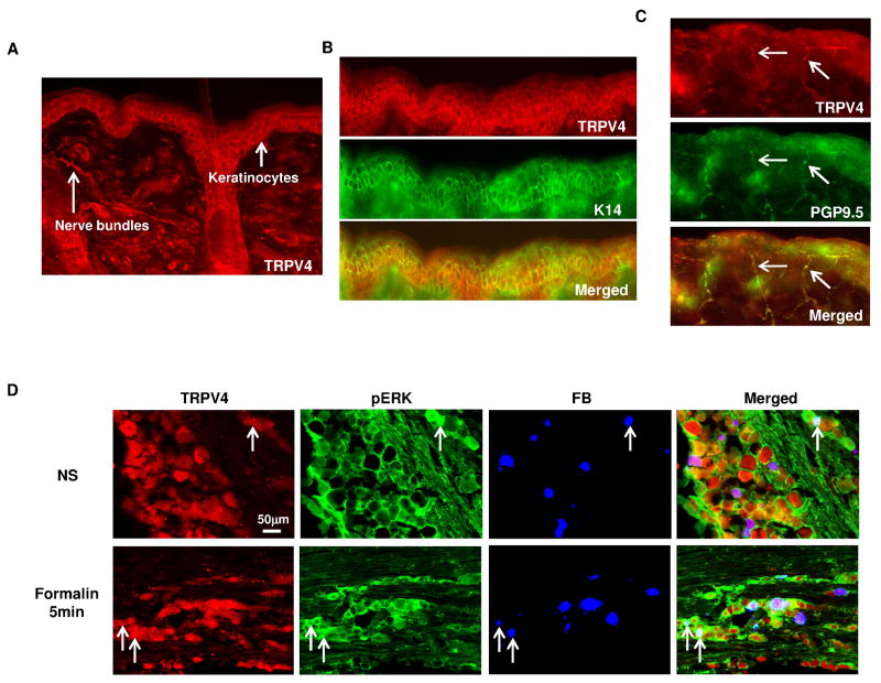 TRPV4 is necessary for trigeminal irritant pain and functions as a cellular formalin receptor