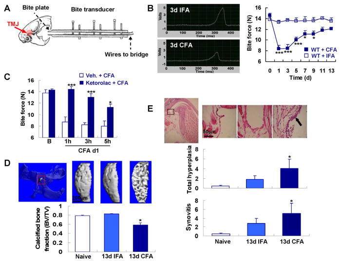 Temporomandibular joint pain: A critical role for Trpv4 in the trigeminal ganglion